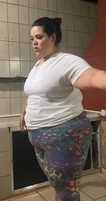 Graziela Janaina antes do tratamento